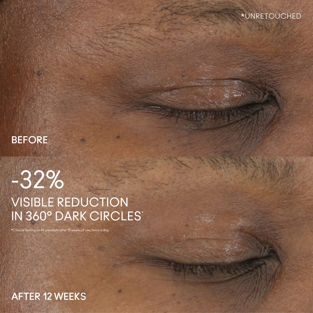 Hyper Real Serumizer™ Eye 360° Bright Eye Treatment - Everyday Beauty Essential